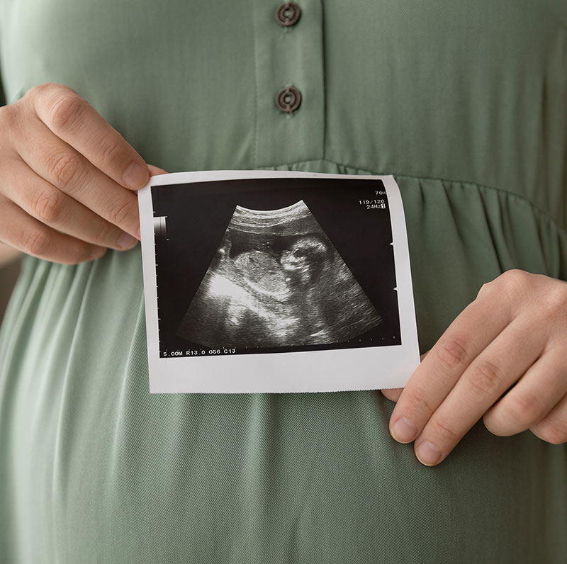 IVF-Care-2