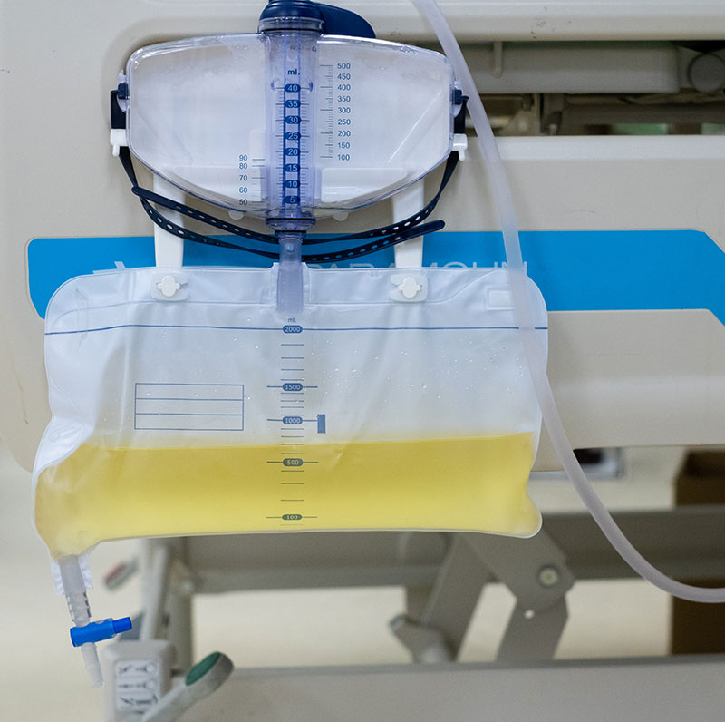 In-Home-Tube-Feeding-1