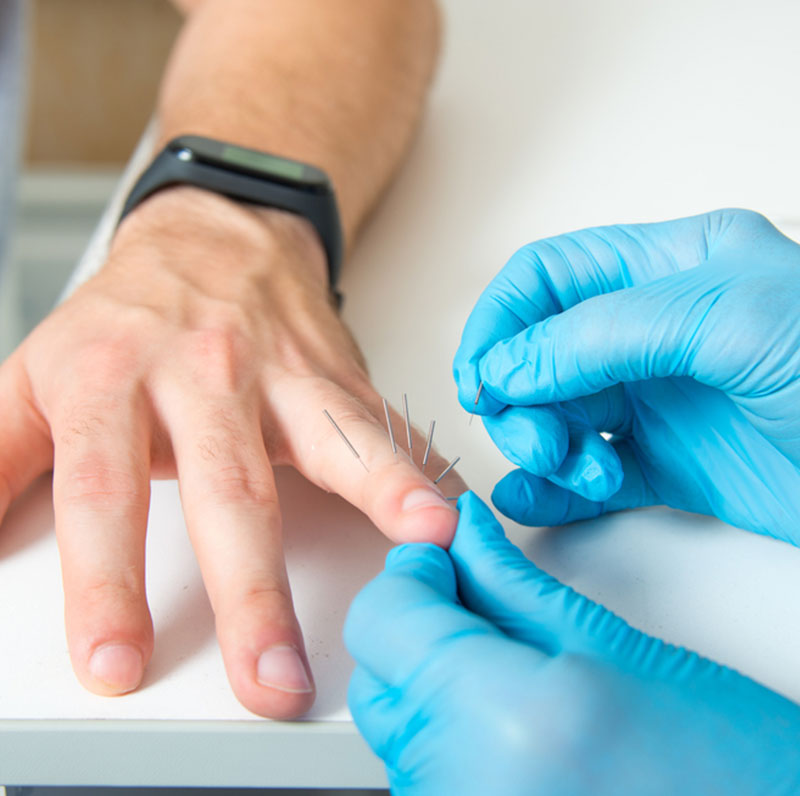 acupuncture-services-at-home2