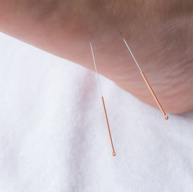 acupuncture-services-at-home3