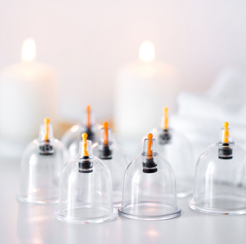 Hijama Cupping Therapy