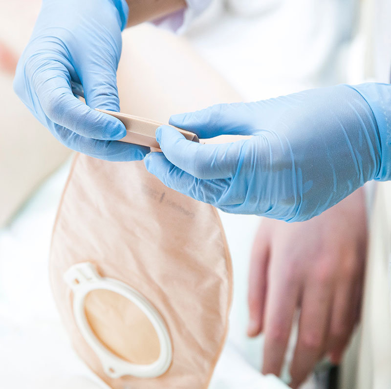 ostomy-care-at-home-1