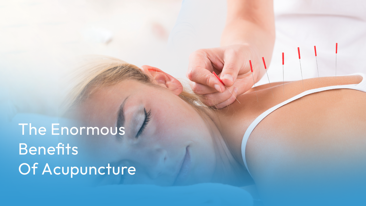 Acupuncture-Treatment-In-dubai-1200x675.png